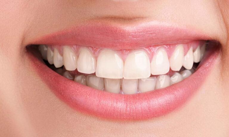 Seek Emergency Dental Care For Dental Bridges Issues?