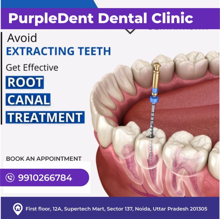 Transforming Smiles: Your Guide to Dental Clinics in Noida Sector 137